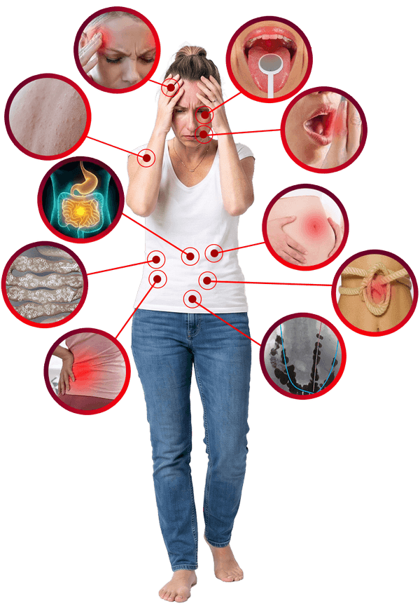 Anatomical diagram showing how gut symptoms spread through the body